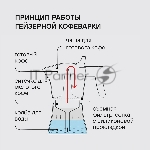 Кофеварка гейзерная Rondell Kafferro RDA-994, 0.45 л, алюминий, черный, вид 16